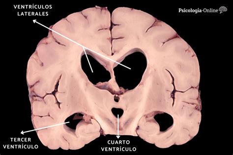Sistema Ventricular Cerebral Qué Es Partes Y Funciones