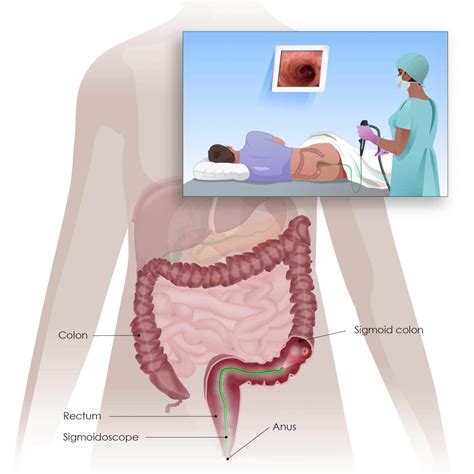 Colorectal Cancer Screening And Testing Digestive Cancers Europe