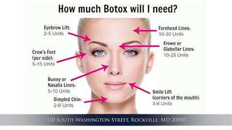 Basics Of Botox Injection Youtube