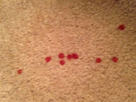 They are both tough to remove. How to Remove Blood Stains from Carpet: 15 Steps (with ...