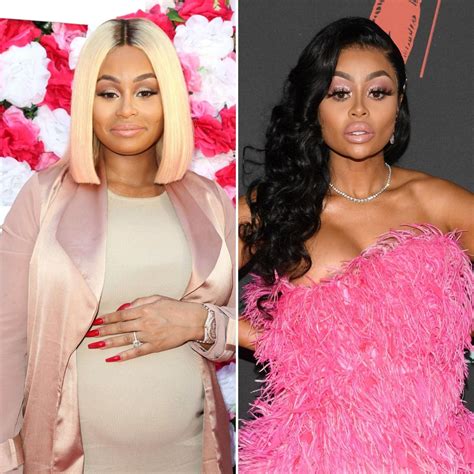 Blac Chyna’s Plastic Surgery Transformation See Photos Of Her Before And After
