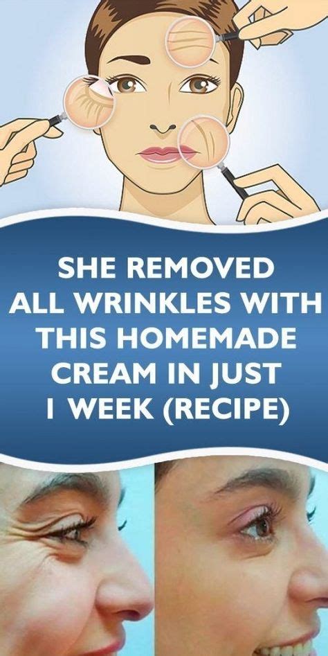 She Removed All Wrinkles With This Homemade Cream In Just 1 Week