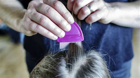 Head Lice Warning ‘super Nits Resistant To Treatment ‘a Problem In