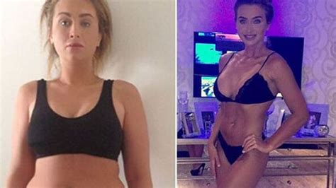 Lauren Goodger Shares Shocking Before And After Photos After Losing