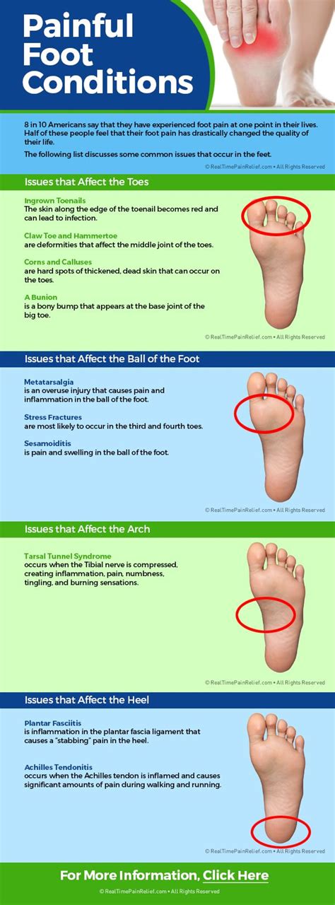 Heel Foot Pain Identifier Chart
