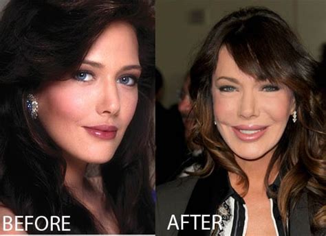 hunter tylo plastic surgery before and after celeb surgery