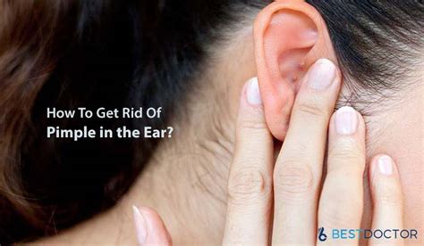 How To Get Rid Of Pimple In The Ear