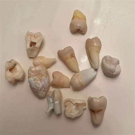 10 cracked and broken real human teeth molars premolars and anteriors etsy