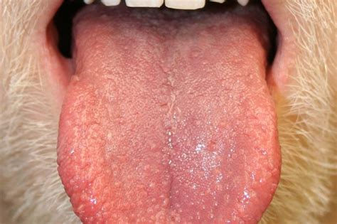 Bumps On The Tongue What It Could Mean Readers Digest