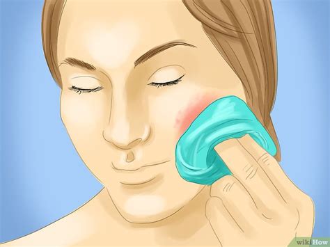 How To Get Rid Of Rashes On The Face Blog How To Do Anything