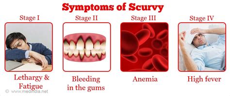 Scurvy Causes Symptoms Diagnosis Treatment And Prevention