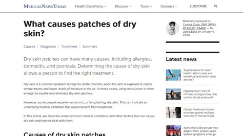 White Dry Patches On Skin Beauty Tips