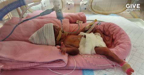 Help Extremely Premature Baby Safiyya
