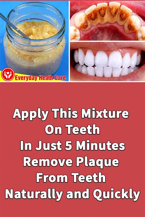 Apply This Mixture On Teeth In Just 5 Minutes Remove Plaque From