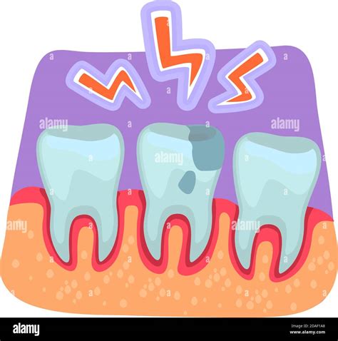 Toothache Flat Concept Vector Illustration Stock Vector Image And Art Alamy