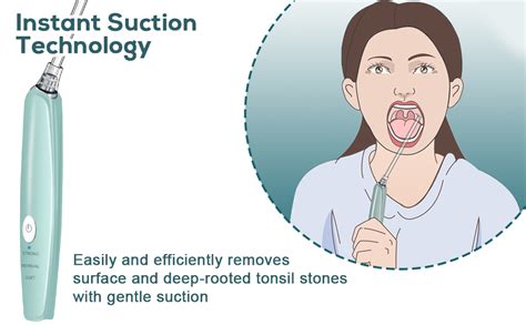 Electric Tonsil Stone Remover Vacuum Pro Grade Tonsil