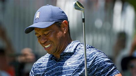 Photo Reveals True Extent Of Tiger Woods Leg Injury After Car Accident