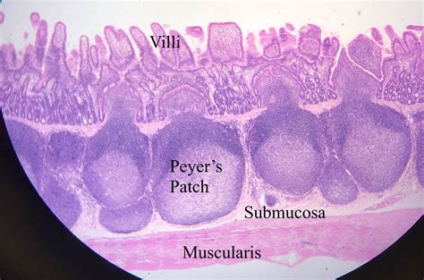 Histology Pre Lab 10 Intestines Jejunum Ileum Colon And Appendix Images And Photos Finder