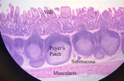 Histology Pre Lab 10 Intestines Jejunum Ileum Colon And Appendix