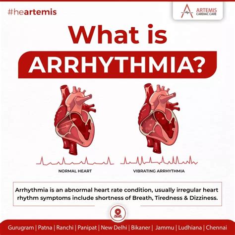 Ppt Revolutionizing Arrhythmia Diagnosis And Treatment Powerpoint