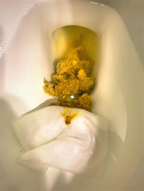 Red Spots In Poop