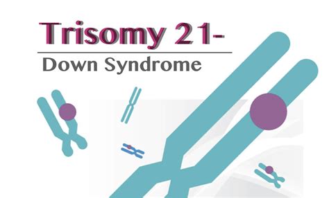 Genetic Education — Trisomy 21 Down Syndrome Definition Causes