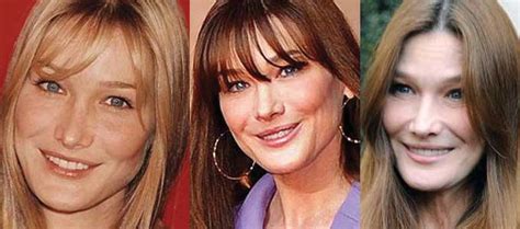 Find carla bruni tour schedule, concert details wed • 8:30pm. Carla Bruni Plastic Surgery Before and After Pictures 2021