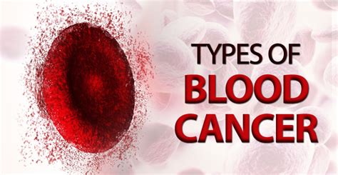 Types Of Blood Cancer Candrol Cancer Treatment And Research Center