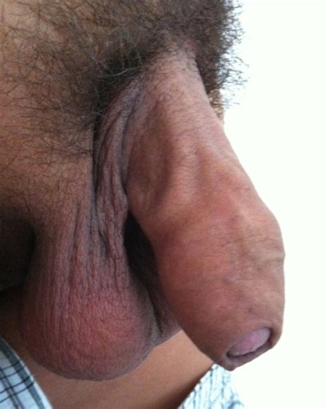 Long Foreskin Penis