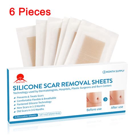 Medical Silicone Gel Scar Removal Sheet Scar Removal Patch Buy