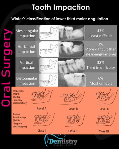 Winter S And Pell Gregory S Classifications Of Third Molar Impaction