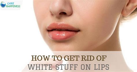 How To Get Rid Of White Stuff On Lips Chapped Lips White Lips Lips