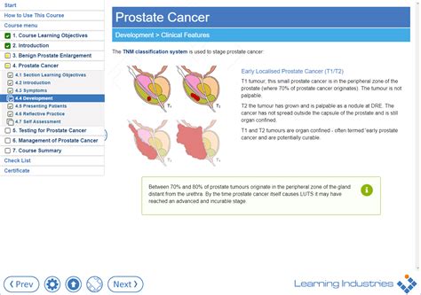Prostate Cymru Launch New E Module For Gps Prostate Cymru
