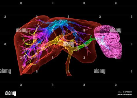 Liver And Spleen And Blood Vessels 3d Coloured Computed Tomography Ct