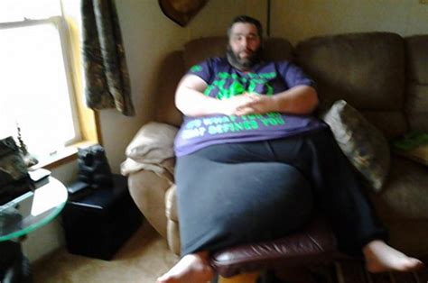 Man With 100 Pound Scrotum Prepares For Surgery Ny Daily News