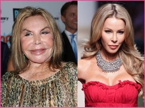 Shocking Celebrities Before And After Celebrities Shocking