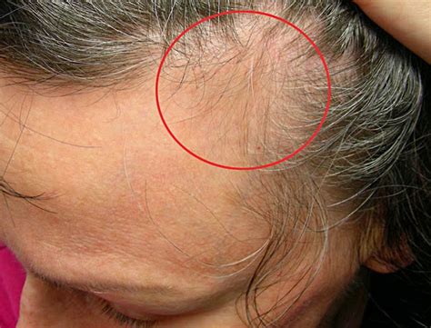 The cells in the hair bulb divide rapidly, producing new hair fibers that are going to continue to grow as the follicle itself is anchored deep into the dermal layer, supplying the strand with nourishment. Caffeine and Hair Growth - Case Study Update