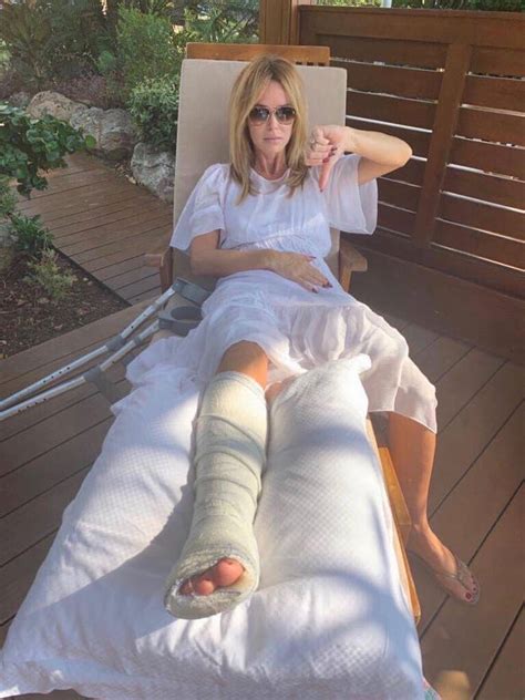 Amanda Holden Shares First Snap Of Broken Leg After Horrific Accident
