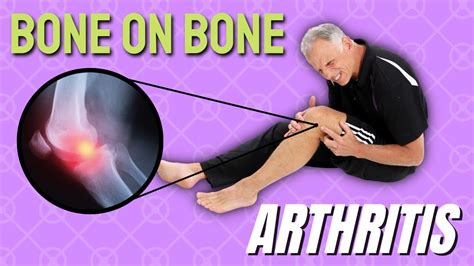 Bone On Bone Knee Arthritis And Pain Top 3 Things To Try Youtube