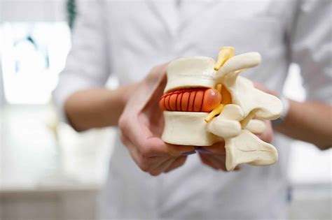 Herniated Disk And Chiropractic Care Sarasota Upper Cervical