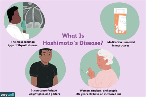 Sindrome De Hashimoto