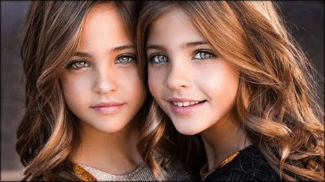 así lucen las gemelas más lindas del mundo