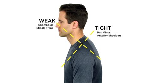 3 common text neck mistakes + how to fix them. How To Correct Your Posture - 5 Exercises To Improve Your ...
