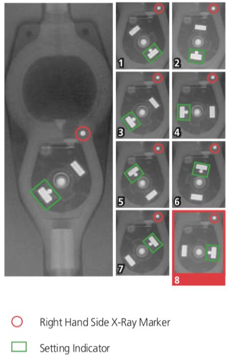 Ventricular Shunt Reference The Neurosurgical Atlas