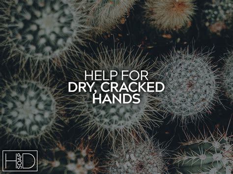 Help For Dry Cracked Hands