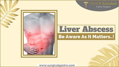 Liver Abscess Types Symptoms Causes And Treatment Best Liver