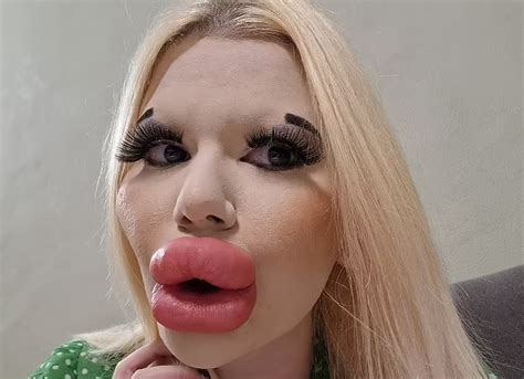 Woman With The World S Biggest Lips Says Men Want To Take Her On Dates And Pay For Her Trips