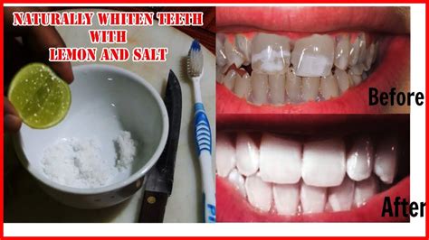 magical teeth whitening remedy get whiten teeth in 3 minutes with lemon and salt youtube