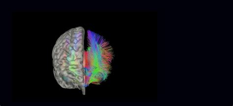 Experience Neurosphere 360° Peter Odonnell Jr Brain Institute Ut