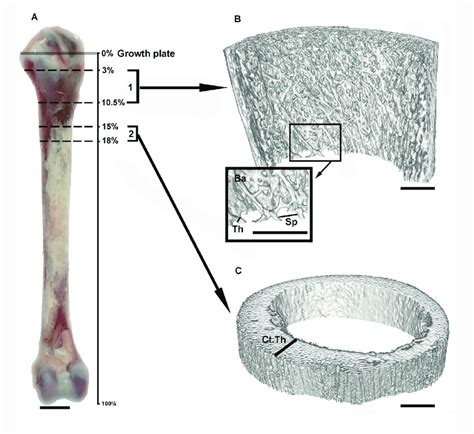 Measurement Of The Trabecular And Cortical Bone Properties Using μct